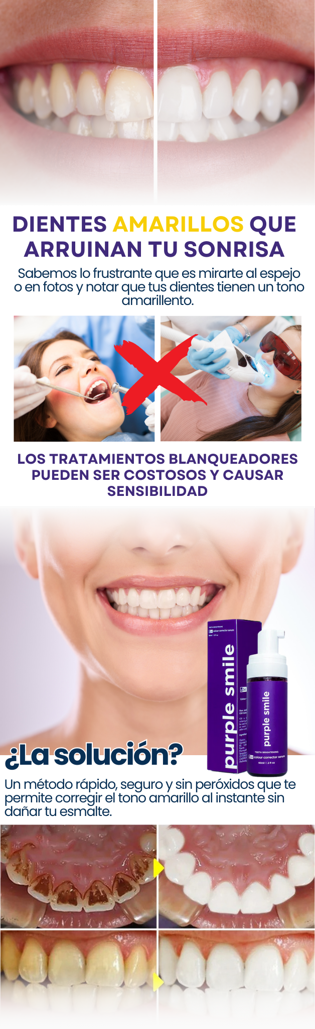 Crema Blanqueadora HiSmile