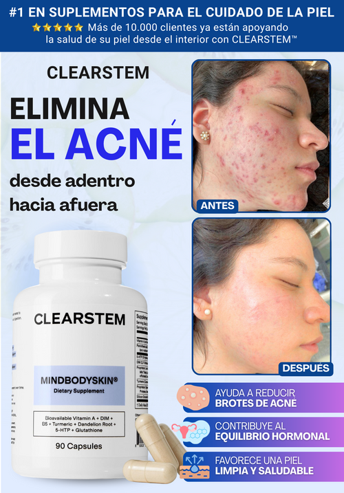 CLEARSTEM ELIMINA EL ACNÉ